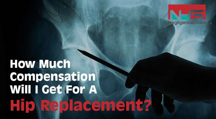 Hip Replacement Compensation Claims - NHSNegligenceClaim